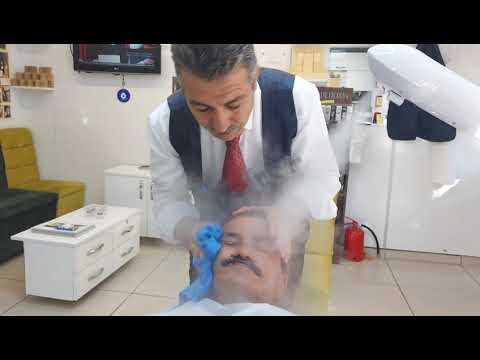 ASMR /ACNE TREATMENT WITH A WONDERFUL FACE CLEANING STEAM MACHINE