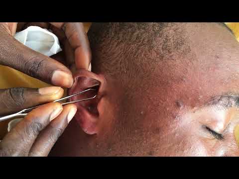 Full Face Nitpicking For Those Who Want To Sleep/ soft bumbles #asmr #satisfying