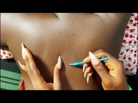ASMR SATISFYING DEEP EAR NITPICKING CLEANING MASSAGE AND SCALP SCRATCH, BACK SCRATCHING