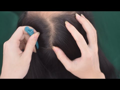 ASMR Hair Parting No Talking, Real Person Scalp Scratching Massage, Head Tingles For Relaxation