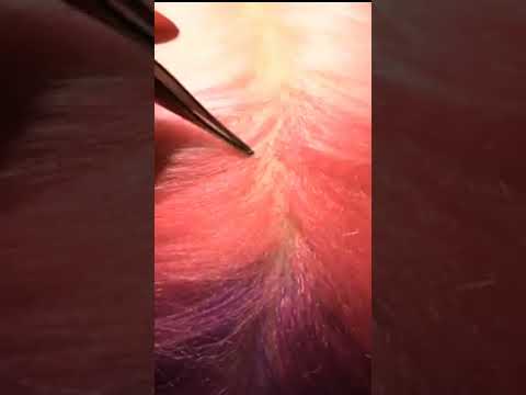 ASMR Scalp Scratching with Tweezers (NO TALKING) #Shorts