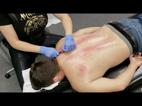 EVERYONE SHOULD SEE THIS! Major TOXIC Release of Spinal Tension Through Chiropractic Adjustments