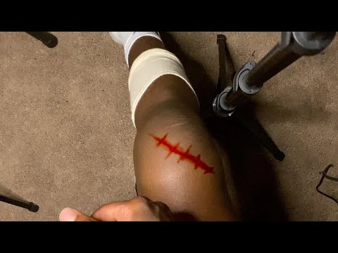 ASMR Broken Knee Therapy Session (For Sleep)