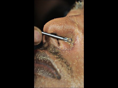 Satisfying Golden Face Massage With Blackheads Removal ASMR #shorts