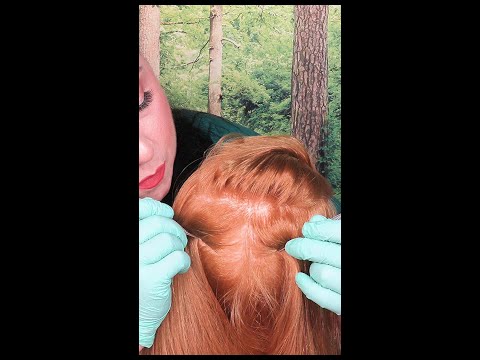 ASMR Scalp Check with Tweezers (NO TALKING) #shorts