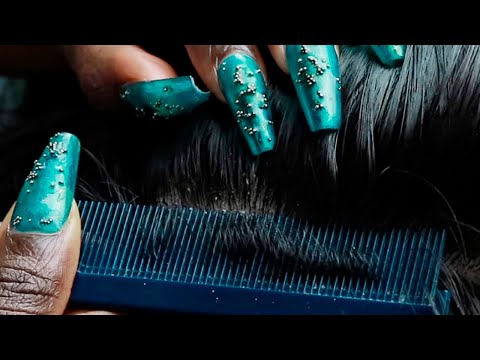 ASMR Attentive Scalp SCRATCHING Sleep Triggers 😴 | no talking