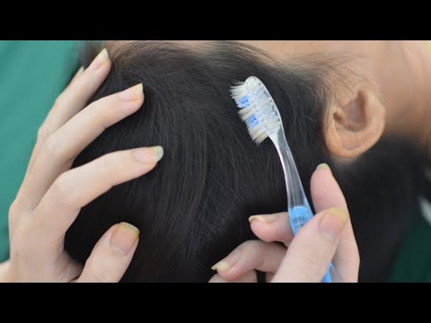 ASMR Real Person Scalp Check With Toothbrush Relaxing For Deep Sleep