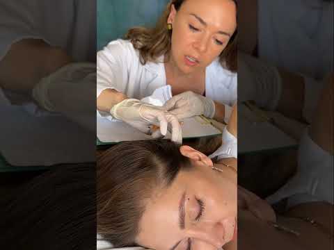 Asmr scalp tingles #asmr #asmrsounds #asmrvideo #relax #relaxing #satisfying #hair #sleep #tingles