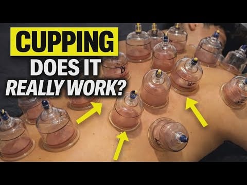 ASMR 🇻🇳 Cupping Therapy & Deep Massage | No Talking | Full Relaxation