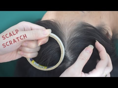 ASMR Head Scratching Aggressive, Real Person Head Massage For Headache Reduce