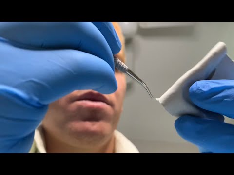 ASMR Dentist Role Play | Dental Scraping and Cleaning