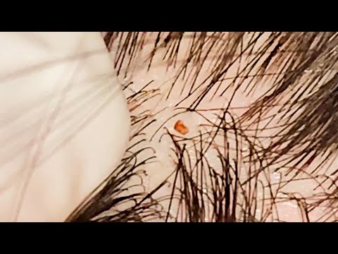 ASMR Checking Scalp & Beard With A Microscope 🔬 | Layered Sounds ☁️