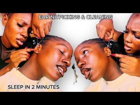 ASMR EAR CLEANING, EAR EATING AND HEAD SCRATCHING