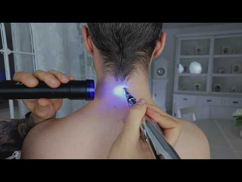 Complete Neck Examination & Ear Alignment