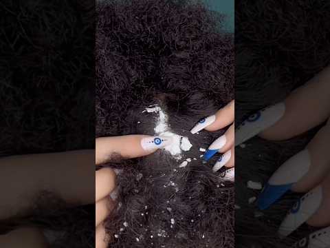 Hair Cleaning 💆🏻‍♀️ #asmr #relax #visualtingle #satisfying