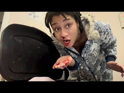 Vlog #152 - Bleeding Out