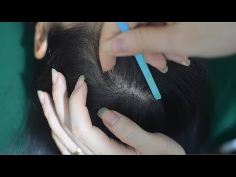 ASMR Scalp Scratching Sounds, Real Person Hair Parting, Hair Brushing Tingles For Stress Relief
