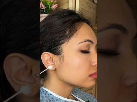 Asmr ear 👂 exam #asmr #relax #relaxing #asmrsounds #asmrvideo #tingles #medical #satisfying #sleep