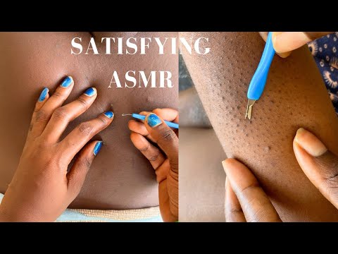 ✨ASMR✨SLEEP IN 5Mins…New Month Tingles -With Bubble Gum