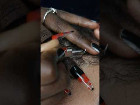 The most relaxing scalp NITPICKING ever #shorts #youtubeshorts #asmr #relaxing