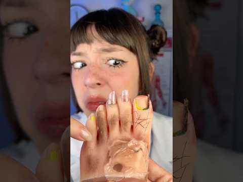 ele precisava de uma limpeza no pé urgente 😳🦶#asmr #funny