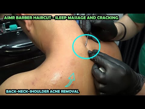 ASMR DEEP SHOULDER ACNE REMOVAL 💈 HAIRCUT 💈 EAR BURN 💈CRACKS💈 tickle head,foot,chest,armpit massage