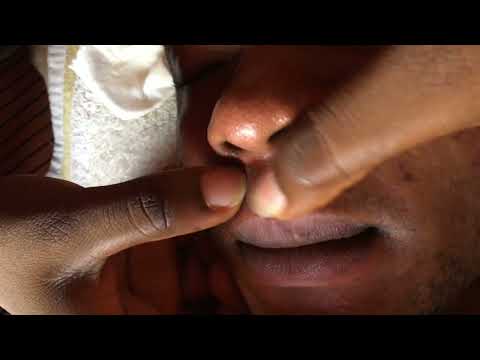 Asmr Best Nitpicking for a good sleep. #satisfying  #asmr #satisfying
