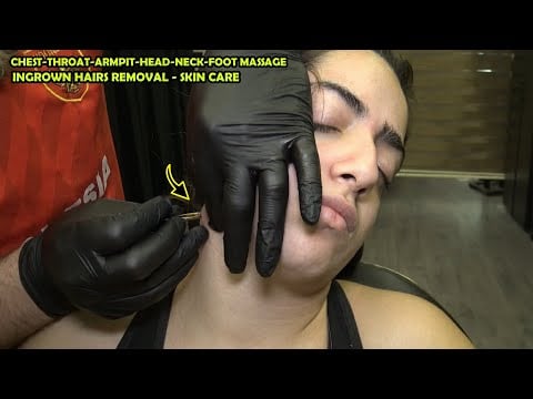 ASMR INGROWN HAIRS & SKIN CARE TREATMENT + CRACKS + Tickle Armpit,head,face,ear,chest,back massage