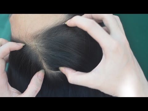 ASMR Head Scratch, Hair Sounds With Scratching, Parting And Combing For Relaxation