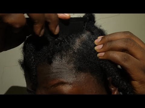 ASMR Intense Aggressive Scalp Scratching & Gum Chewing ​⁠