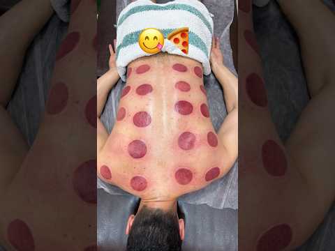 pizzapeperoni😋😍#explore #asmr #shorts #massage #cupping #relax #fyp #youtubeshorts