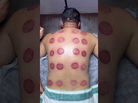 pizza peperoni😍🍕#cupping #cuppingtherapy #shorts #asmr