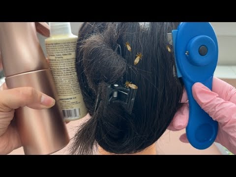ASMR| Checking your hair for Lice- You came back from summer camp infested with lice 🫣