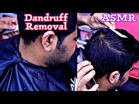 Most satisfying Dandruff removal with ASMR sound | Comb massage with dandruff treatment asmr