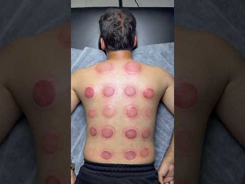 😍🍕#shorts #asmr #cupping #viral #trending