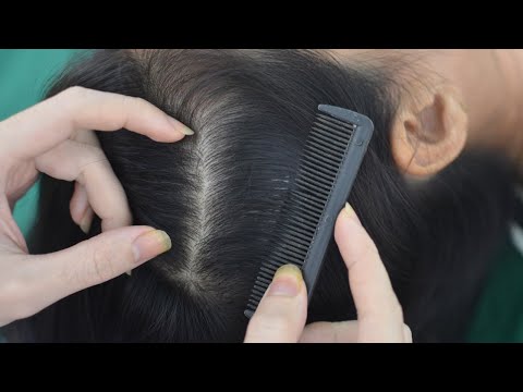 ASMR Scalp Check ~ Scalp Scratching ~ Hair Parting ~ Hair Brushing With Comb ( No Talking Asmr )