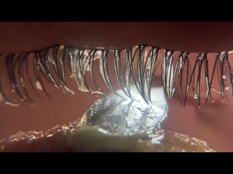 ASMR Eye Cleaning 👁️💦🧼 With Various Liquids Tingly Wet Mouth Sounds 💤