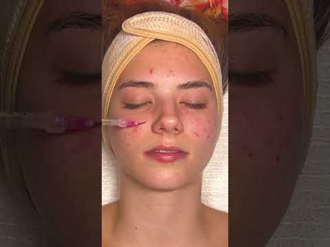 ASMR Relaxing Facial on @katemariess