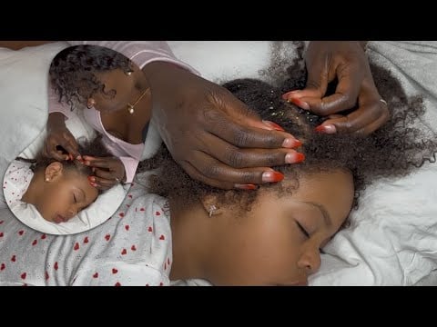 ASMR nitpicking tiny sprinkles from my baby's scalp. 