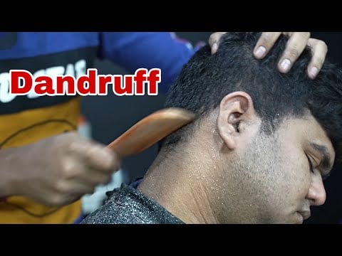 ASMR Satisfying Dandruff Scratching | Heavy Oil Head Scratching | Scratching & Tapping Compilation