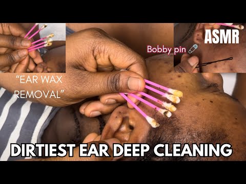 ASMR⭐️DIRTIEST EAR DEEP CLEANING WITH BUDS&BOBBY PIN” SATISFYING EAR WAX REMOVAL FOR DEEP SLEEP