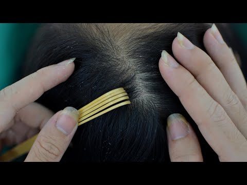 ASMR Scalp Check ~ Scalp Scratching ~ Scalp Cleansing ~ Scalp Picking ~ Scalp Treatment For Sleep ~