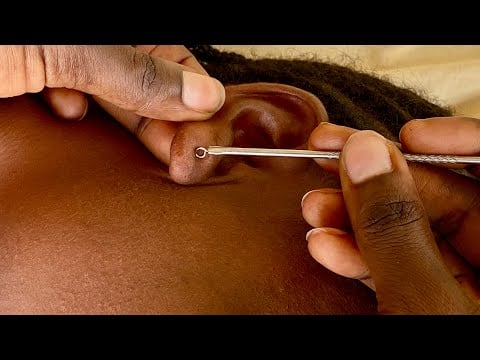 ✨Asmr ✨real person ear cleaning & picking well zoomed - Bubble gum, Rain sound.
