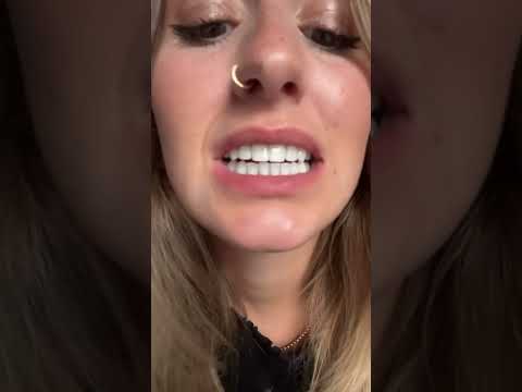 Do you like my teeth? 😘