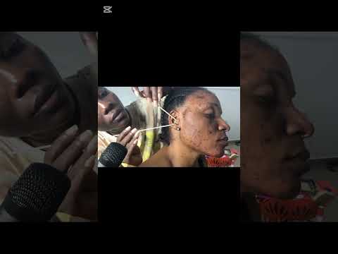 ASMR DENTAL FLOSSING YOUR DIRTY EARS, BACK SCRATCHING AND HEAD SCRATCHING NITPICKING #earcleaning