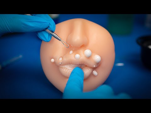 Asmr QUITANDO ESPINILLAS, VISITA MÉDICA CURANDO TU CARA | ASMR Español | Asmr with Sasha