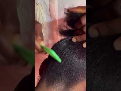 hair scalp treatment asmr, scalp Scratching #tingling #asmr #scalpscratching #scalpcheck