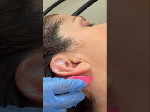 Asmr ear cleaning #relax #asmr #asmrsounds #asmrvideo #satisfyingvideo #satisfying #oddlysatisfying