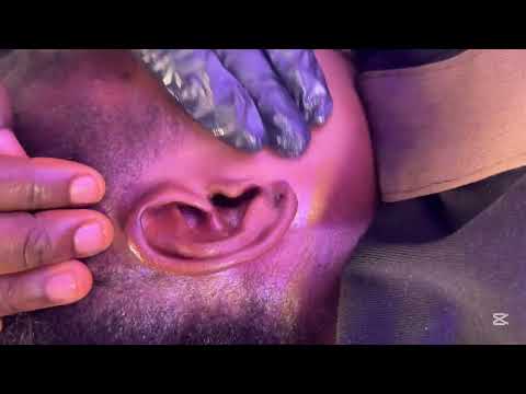ASMR EXTREME EAR CLEANING AND MASSAGE VERY SATISFYING FOR SLEEP