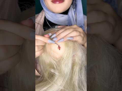 The Bugs Stuck In Your Scalp 🐜😵‍💫 #asmr #satisfying #visualtingle #asmrmassage #relax #shorts